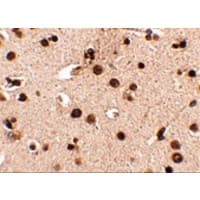 Polyclonal Rabbit anti-Human RIMS3 Antibody (IHC, IF, WB)