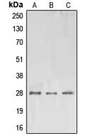 EPO / Erythropoietin Antibody (Internal)