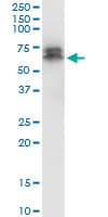 Monoclonal Mouse anti-Human PDPK1 / PDK1 Antibody (clone 2E2, WB)