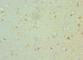 CHRM3 / M3 Antibody (aa270-470)