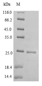Mouse DOCK8 Protein (Recombinant 6His, N-terminus)