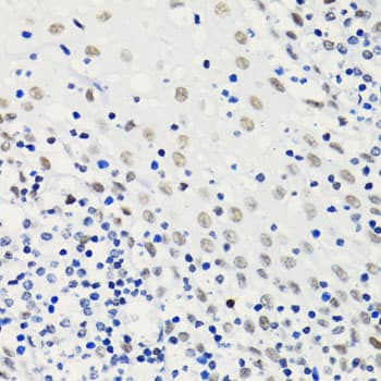 HIST2H4A Antibody