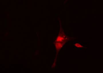 CML / BCR Antibody
