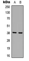 Polyclonal Rabbit anti-Human HNRNPD / AUF1 Antibody (Internal, IHC, IF, WB)
