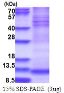 Human NDUFA4 Protein (Recombinant His)
