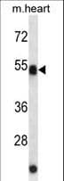 AUTL1 / ATG4C Antibody