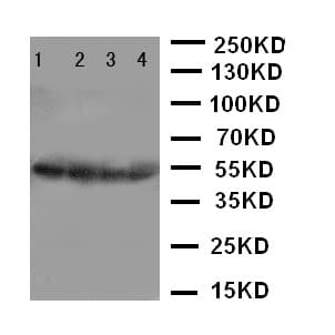 CSTA / Cystatin A Antibody (aa77-90)