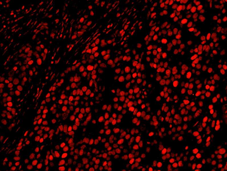AKAP8L Antibody (aa596-646)