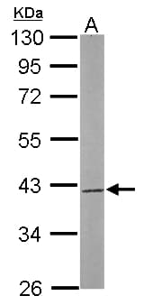 Polyclonal Rabbit anti-Human SAE1 Antibody (aa3-247, IHC, WB)