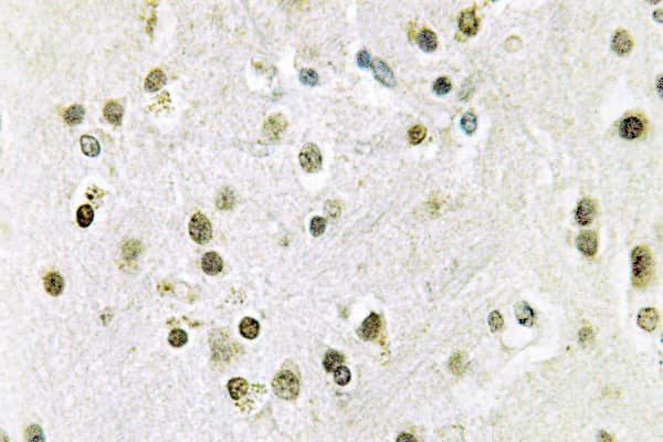 DGKQ Antibody (Ser725)
