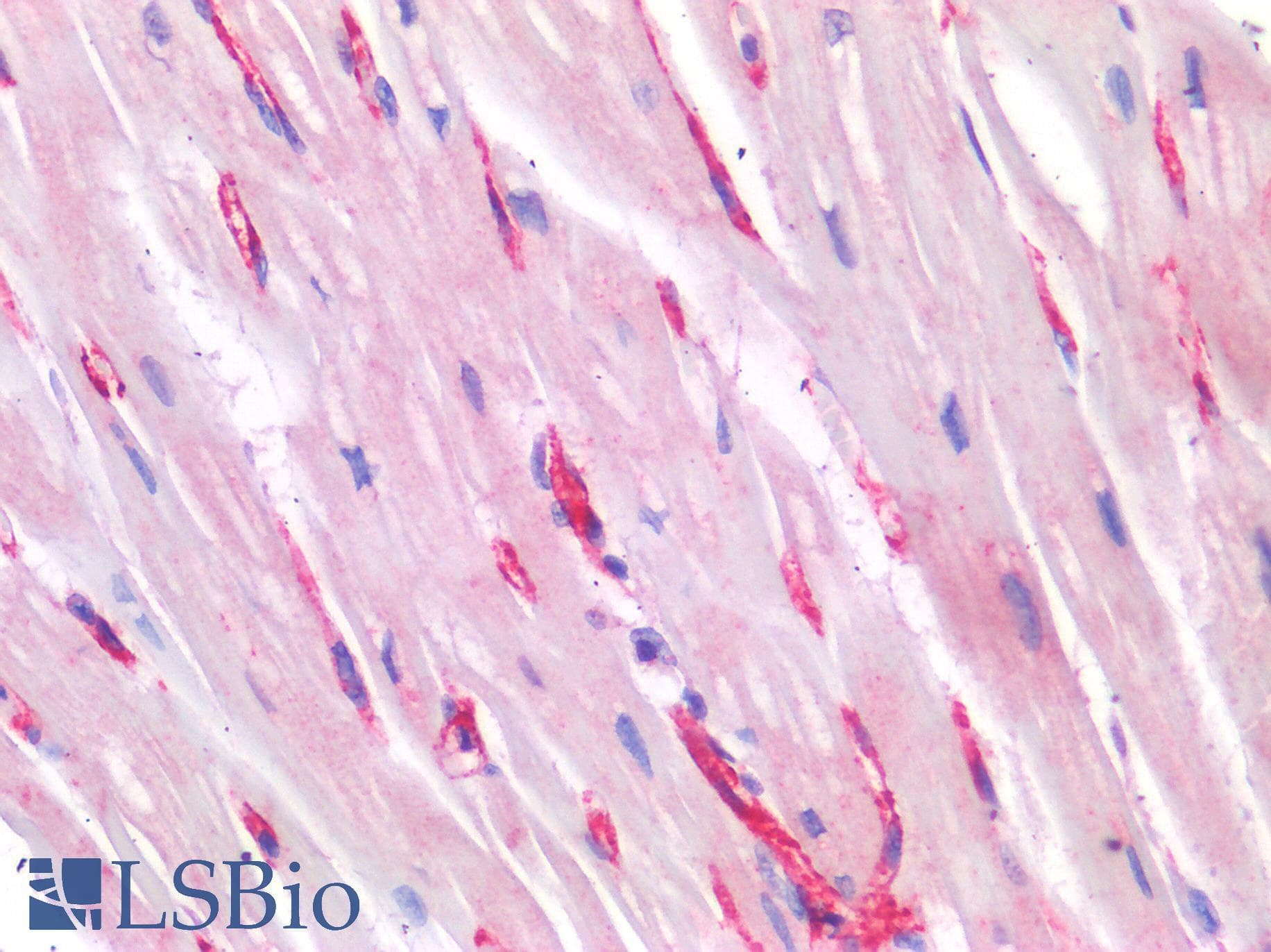 IHC-plus™ PECAM-1 / CD31 Antibody