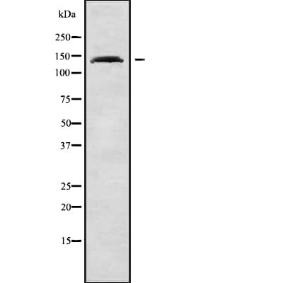 ULK4 Antibody