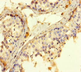ROPN1 / Ropporin Antibody