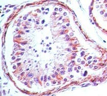 TLR4 Antibody (aa100-200, clone 76B357.1, Azide-free)