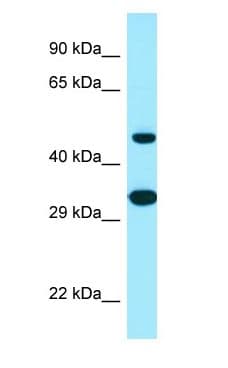 SCD5 / SCD4 Antibody (C-Terminus)