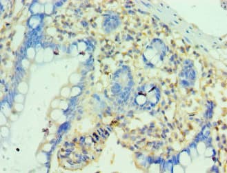 PTRH2 / BIT1 Antibody (aa40-179)
