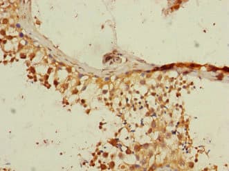 Polyclonal Rabbit anti-Human RGS14 Antibody (IHC)
