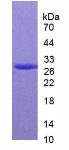 Rat CA2 / Carbonic Anhydrase II Protein (Native)
