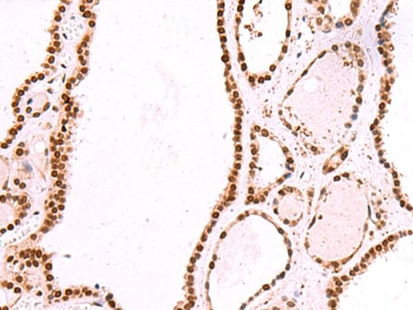 IRF2BP1 Antibody