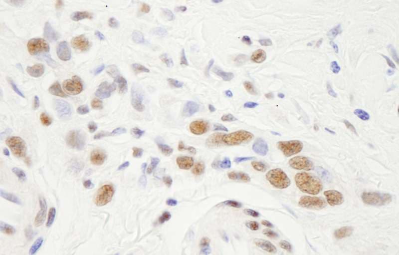 Polyclonal Rabbit anti-Human NFYA Antibody (aa333-347, IHC)