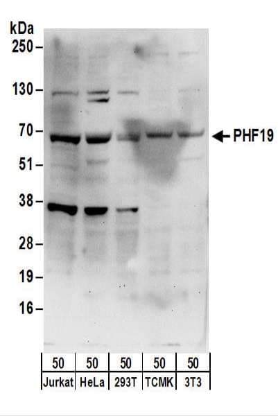PHF19 Antibody (aa530-580)