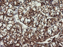 ACAA2 Antibody (clone OTI1D3)