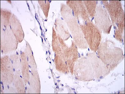 Monoclonal Mouse anti-Human IL-1B / IL-1 Beta Antibody (clone 3A6, IHC, IF, WB)
