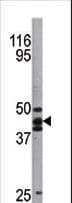 Polyclonal Rabbit anti-Human TP53 / p53 Antibody (phospho-Ser20, IHC, WB)