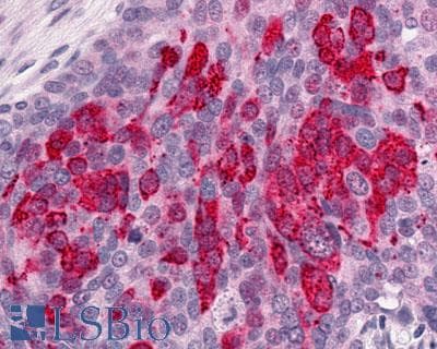 PathPlus™ Polyclonal Rabbit anti-Human GPR1 Antibody (C-Terminus, IHC)