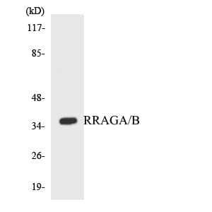 Polyclonal Rabbit anti-Human RRAGA+B Antibody (aa252-301, WB)