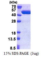 Human TBC1D13 Protein (Recombinant His)