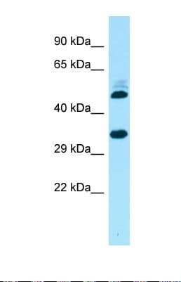 RCD1 / RQCD1 Antibody (aa139-188)