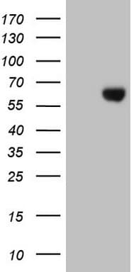 ESRRB / ERR Beta Antibody (aa1-252, clone OTI12B7)