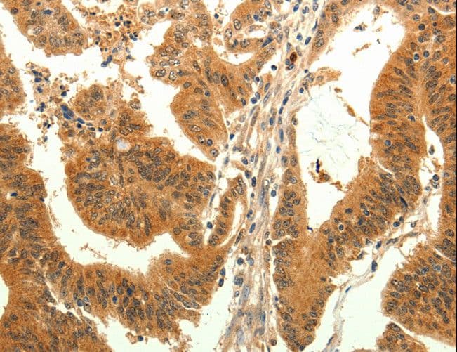 TRPM7 Antibody