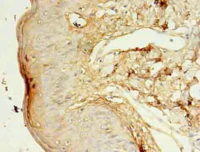 KLK5 / Kallikrein 5 Antibody (aa23-293)