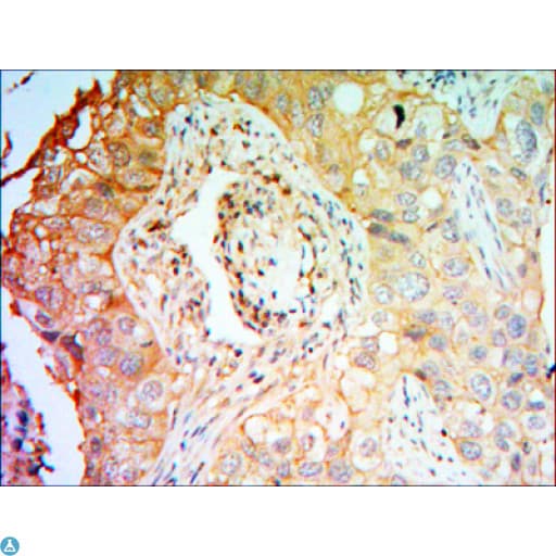 CCK4 / PTK7 Antibody