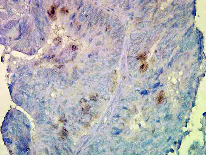 HSP90 Beta Antibody (clone Hyb-K3701)