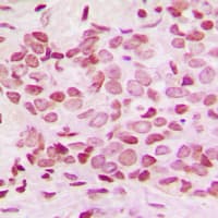 Polyclonal Rabbit anti-Human NFKB2 Antibody (C-Terminus, IHC, IF, WB)