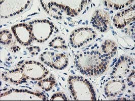 TBC1D21 Antibody (clone OTI1C7)