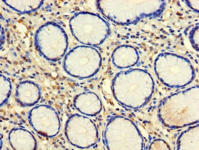 CLEC18A Antibody