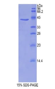 Mouse PFN1 / Profilin 1 Protein (Recombinant His-GST)