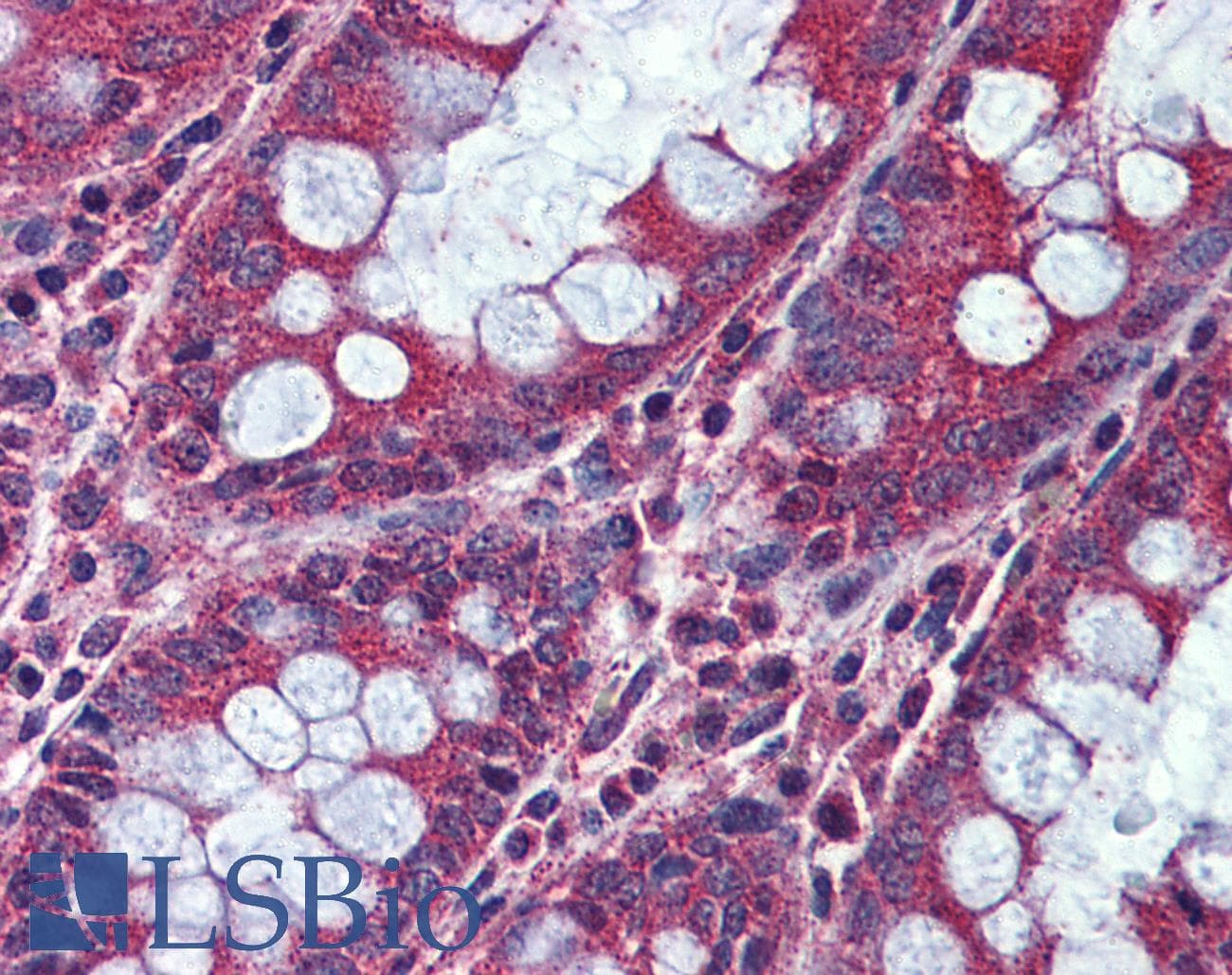 IHC-plus™ ACVR1C / ALK7 Antibody (Internal)