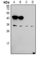Polyclonal Rabbit anti-Human EFNA5 / Ephrin A5 Antibody (WB)