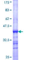 Human TUB / Tubby Protein (Recombinant GST, N-terminus)