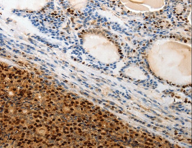TERT / Telomerase Antibody
