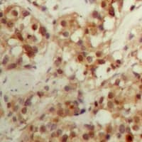 Polyclonal Rabbit anti-Human CBFB Antibody (N-Terminus, IHC, IF, WB)