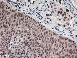MGLL / Monoacylglycerol Lipase Antibody (clone OTI4D1)