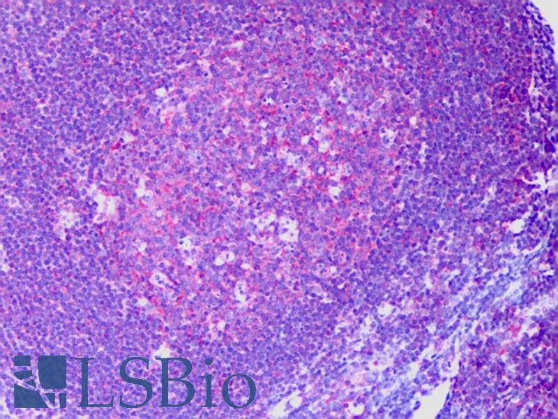 IHC-plus™ Monoclonal Mouse anti-Human RAPGEF6 Antibody (clone 2C5, IHC, IF, WB)