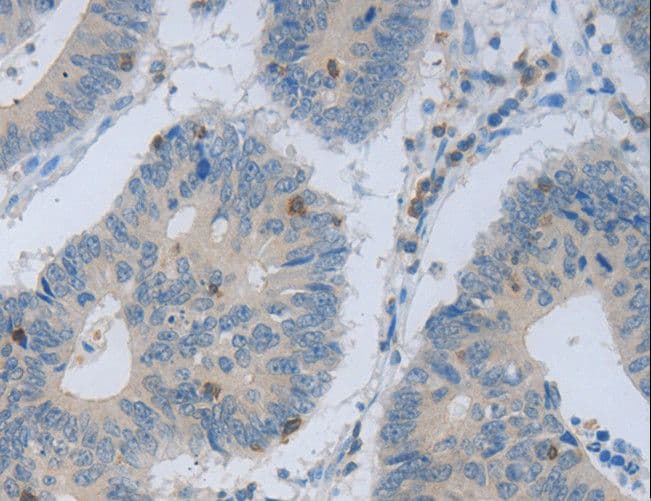 MAGEB4 Antibody