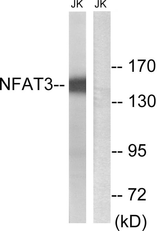 IHC-plus™ Polyclonal Rabbit anti-Human NFATC4 / NFAT3 Antibody (aa136-185, IHC, WB)